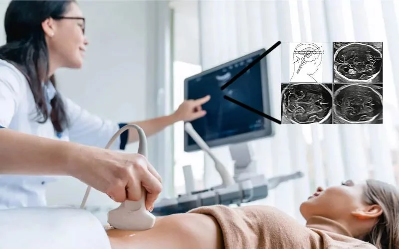 خارج بودن اندازه BPD در سونوگرافی از محدوده طبیعی یعنی چی؟